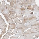 EHBP1 Antibody in Immunohistochemistry (IHC)