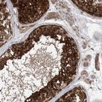 EHBP1 Antibody in Immunohistochemistry (IHC)