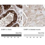 EHBP1 Antibody