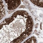 EHBP1 Antibody in Immunohistochemistry (IHC)