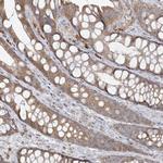 MCAT Antibody in Immunohistochemistry (Paraffin) (IHC (P))