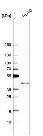 MCAT Antibody in Western Blot (WB)