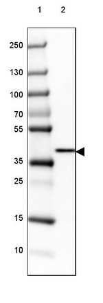 GALM Antibody in Western Blot (WB)