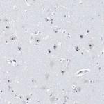 BXDC1 Antibody in Immunohistochemistry (Paraffin) (IHC (P))