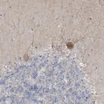 ADAT2 Antibody in Immunohistochemistry (Paraffin) (IHC (P))