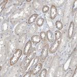 ADAT2 Antibody in Immunohistochemistry (Paraffin) (IHC (P))