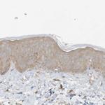 ADAT2 Antibody in Immunohistochemistry (Paraffin) (IHC (P))