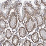 ADAT2 Antibody in Immunohistochemistry (Paraffin) (IHC (P))
