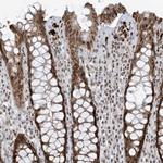 ECT2L Polyclonal Antibody