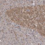 RIN1 Polyclonal Antibody