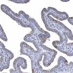TTC21B Antibody in Immunohistochemistry (IHC)