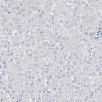 TTC21B Antibody in Immunohistochemistry (Paraffin) (IHC (P))