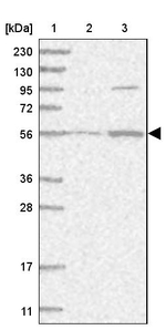 HACL1 Antibody in Western Blot (WB)