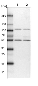 HACL1 Antibody in Western Blot (WB)