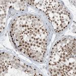 ZNF500 Antibody in Immunohistochemistry (Paraffin) (IHC (P))