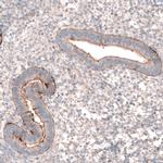 LRRC15 Antibody in Immunohistochemistry (IHC)