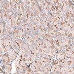 LRRC15 Antibody in Immunohistochemistry (IHC)