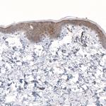 LRRC15 Antibody in Immunohistochemistry (IHC)