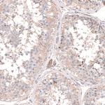 LRRC15 Antibody in Immunohistochemistry (IHC)