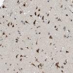 GPR111 Polyclonal Antibody