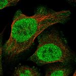 TRANK1 Polyclonal Antibody