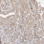TRANK1 Antibody in Immunohistochemistry (Paraffin) (IHC (P))