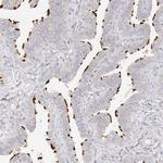 TRANK1 Antibody in Immunohistochemistry (Paraffin) (IHC (P))