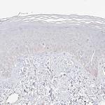 TRANK1 Antibody in Immunohistochemistry (Paraffin) (IHC (P))