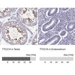 TTC21A Antibody in Immunohistochemistry (IHC)
