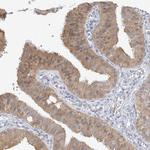 GMPPA Antibody in Immunohistochemistry (IHC)