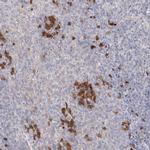 GMPPA Polyclonal Antibody