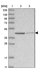 GMPPA Antibody in Western Blot (WB)