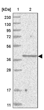 SLC35A5 Antibody in Western Blot (WB)