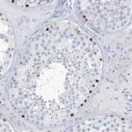 SLC35A5 Polyclonal Antibody
