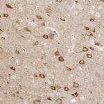 KSR2 Polyclonal Antibody