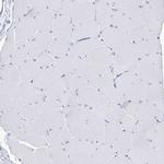 RNF186 Antibody in Immunohistochemistry (Paraffin) (IHC (P))