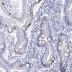 RNF186 Antibody in Immunohistochemistry (IHC)