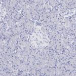 RNF186 Antibody in Immunohistochemistry (IHC)