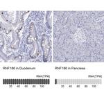 RNF186 Antibody