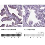 NEK5 Polyclonal Antibody