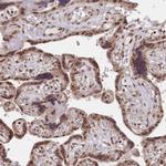 CGGBP1 Antibody in Immunohistochemistry (Paraffin) (IHC (P))