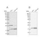 CGGBP1 Antibody in Western Blot (WB)