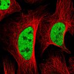 SETD5 Polyclonal Antibody