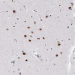 SETD5 Antibody in Immunohistochemistry (Paraffin) (IHC (P))