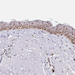 SETD5 Antibody in Immunohistochemistry (Paraffin) (IHC (P))