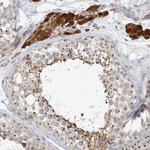 ZCCHC4 Antibody in Immunohistochemistry (Paraffin) (IHC (P))