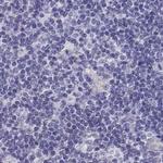 IGSF1 Antibody in Immunohistochemistry (IHC)