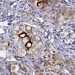 IGSF1 Antibody in Immunohistochemistry (IHC)