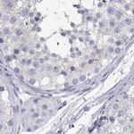 IGSF1 Antibody in Immunohistochemistry (IHC)