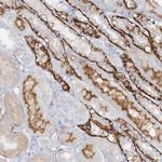 ATP11A Antibody in Immunohistochemistry (Paraffin) (IHC (P))